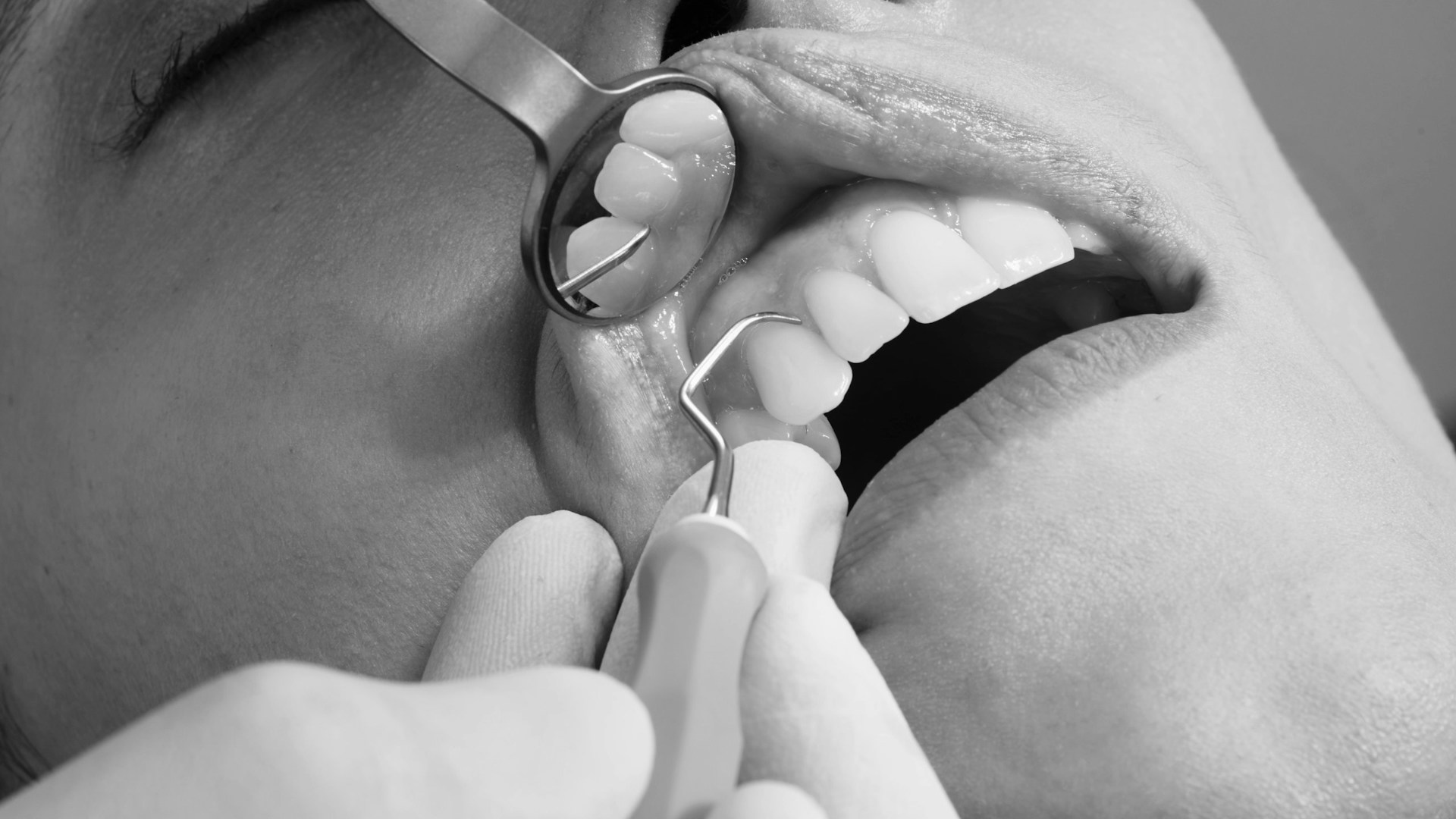An image of a patient being operated on.